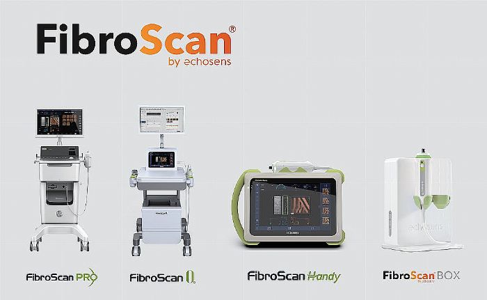 ݼ໼ߣFibroScan ιܼв\xP(gun)zyĿ{t(y)